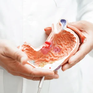 Oesophago Gastric Surgery I - Bariatric